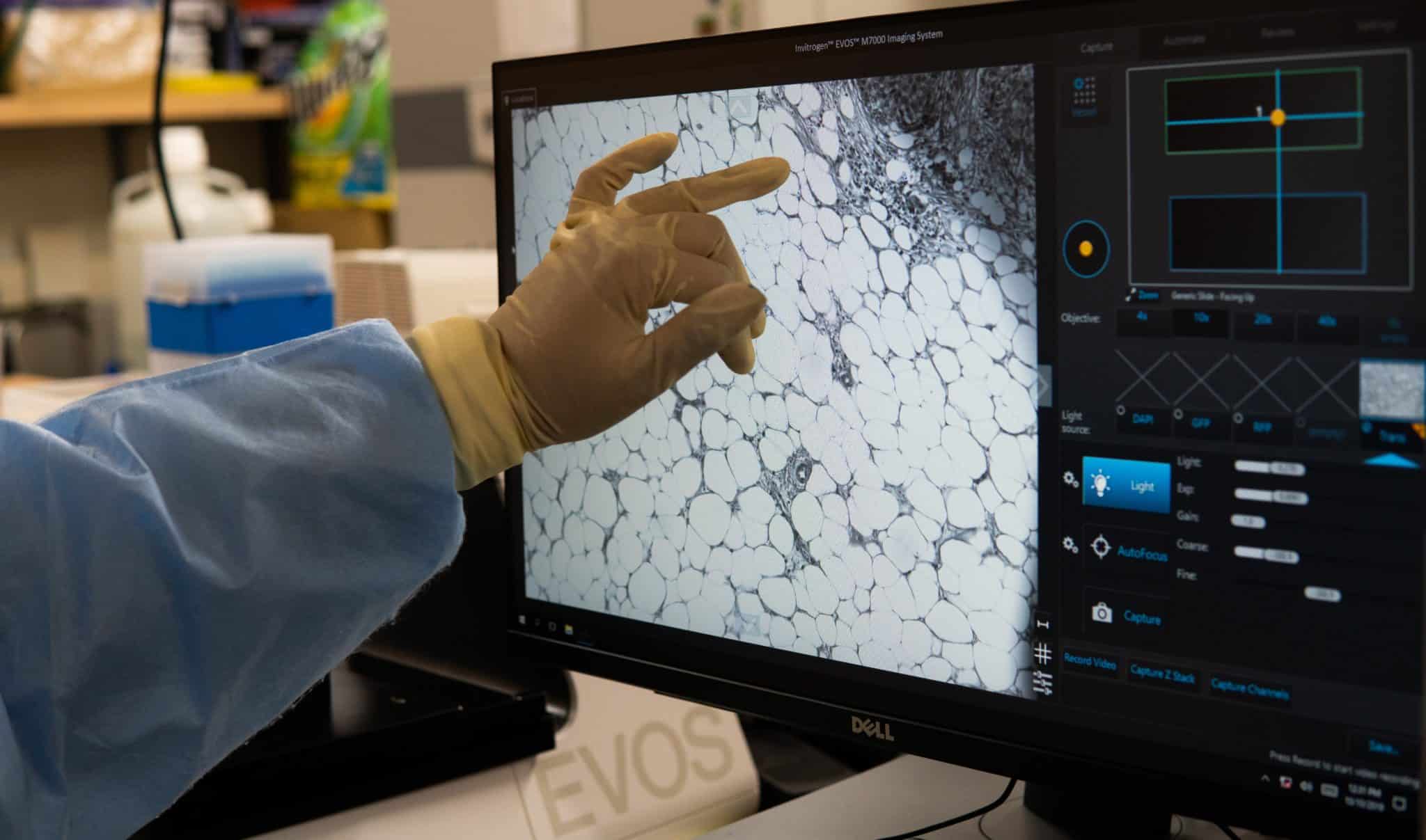 Image of a doctor pointing at a screen showing an image from a microscope